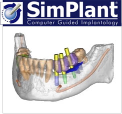 Simplant CGI Illustration